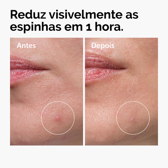 SULFUR 10% POWDER-TO-CREAM CONCENTRATE